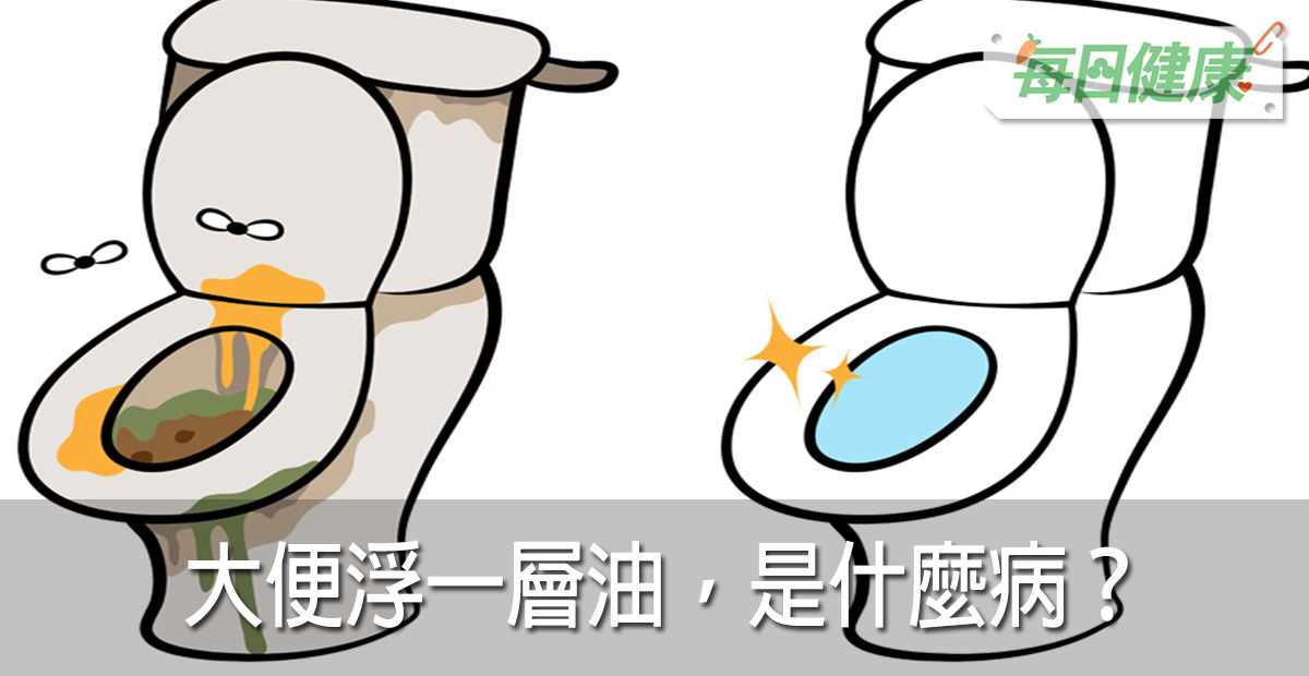 大便油膩膩還會浮在水面上,是什麼病?4種元兇提早釐清,就能避