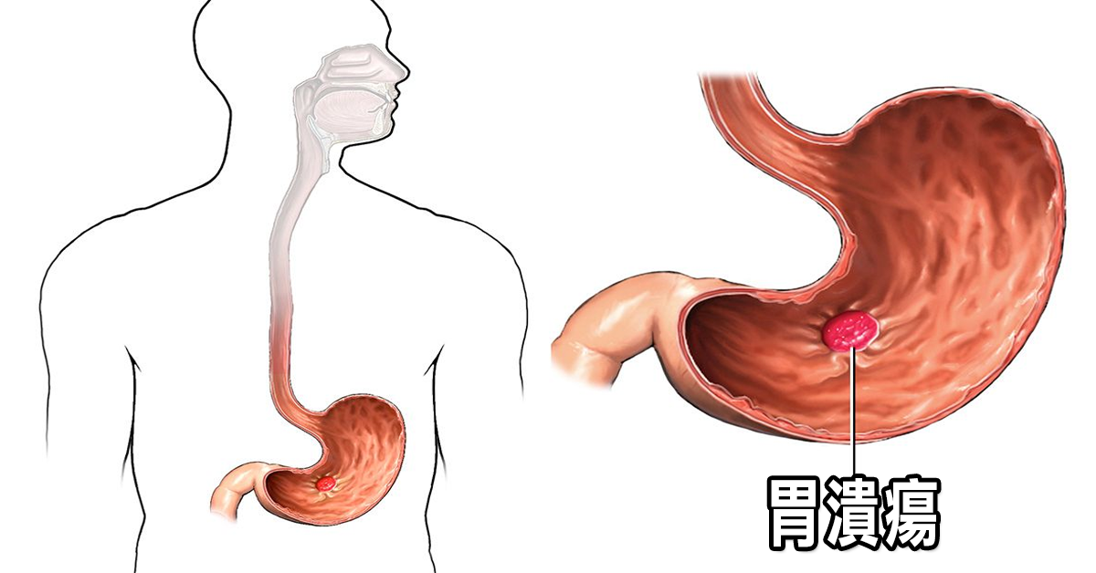 Gensou Stomach